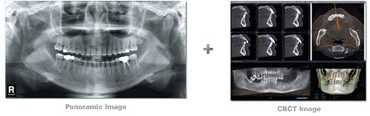 Atlanta Cone Beam Ct Panoramic Cone Beam Ct Panoramic Atlanta